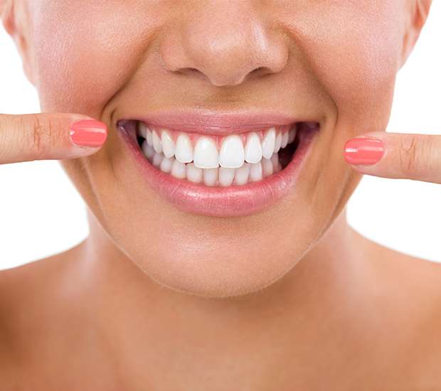 Coral Springs What Is Gum Contouring and Reshaping